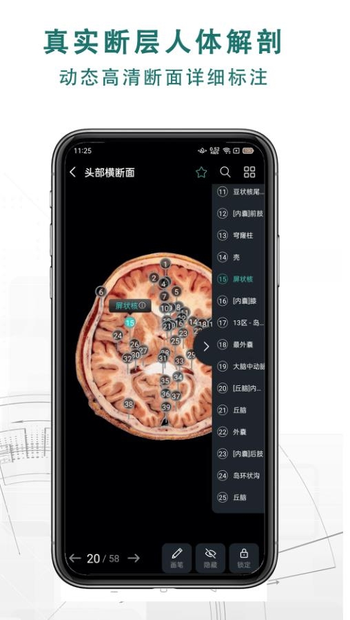 掌上3D解剖
